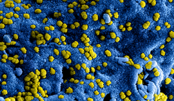 Maatregelen Laverhof ter voorkoming van verspreiding coronavirus